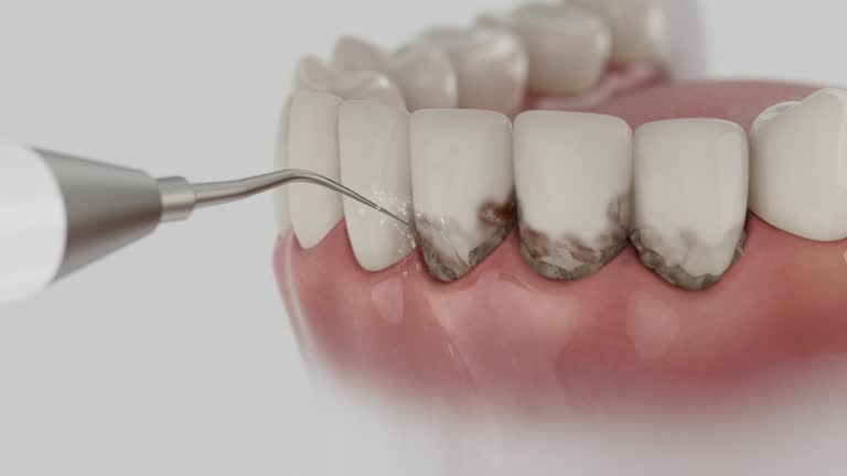 Trusted Teeth Cleaning And Checkup service in Harrison, TN - Dentist Open Now